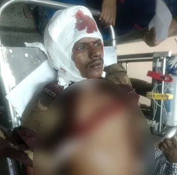 Police attack